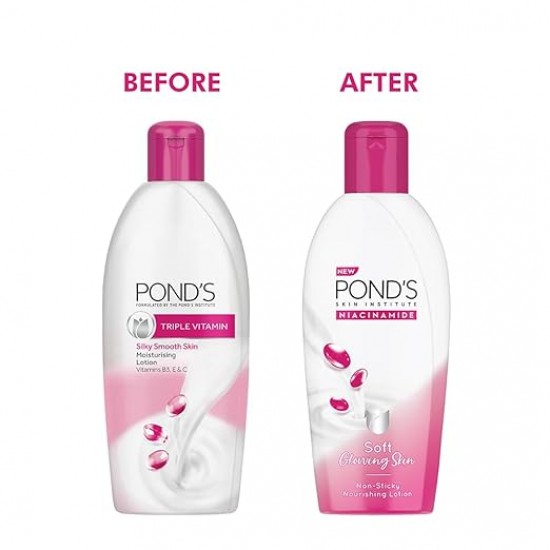 PONDS NIACINAMIDE | SOFT GLOWING SKIN | 3X MOISTIRIZATION | NON-STICKY NOURISHING BODY LOTION | 180 ML